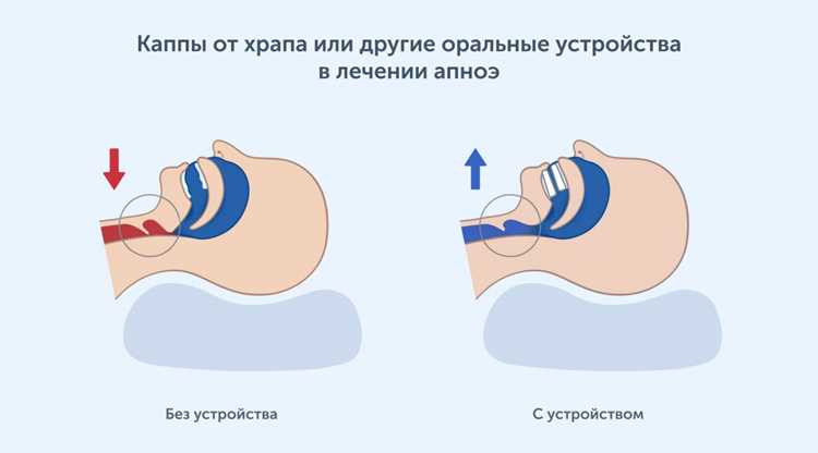 Какие угрозы здоровью несёт храп и как распознать признаки осложнений